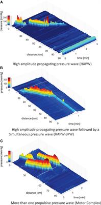 Associations Between Colonic Motor Patterns and Autonomic Nervous System Activity Assessed by High-Resolution Manometry and Concurrent Heart Rate Variability